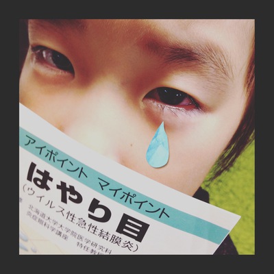 はやり目