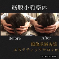 小顔整体