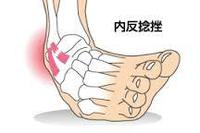 足関節と腰痛！？